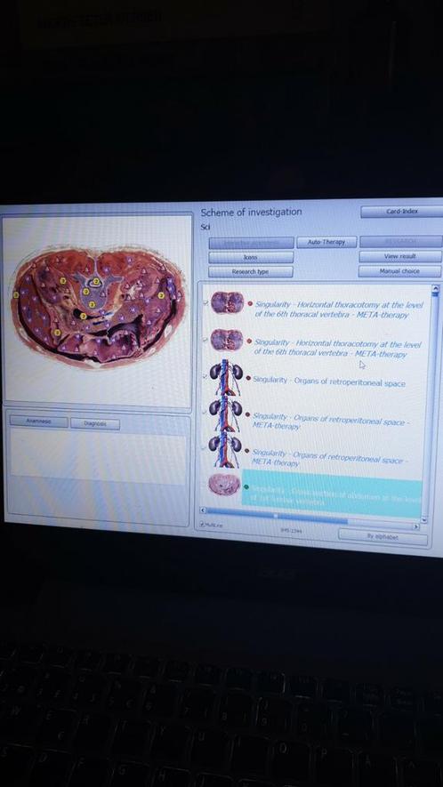 Bioresonantie apparaten te koop